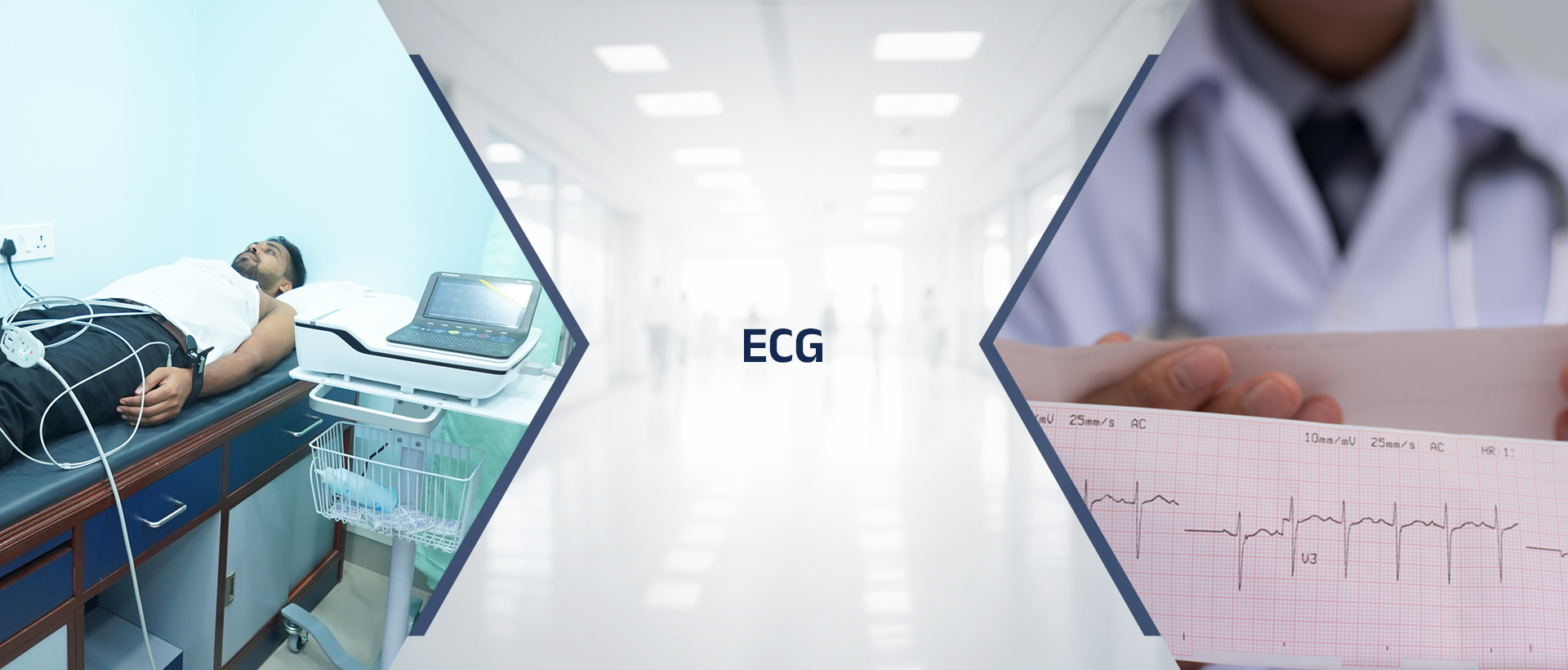 ECG