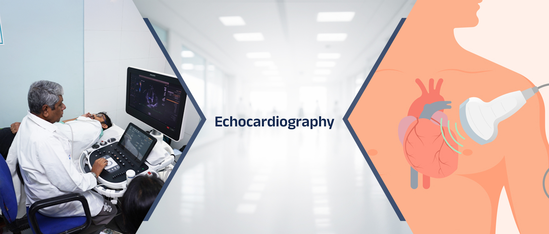 Echocardiography