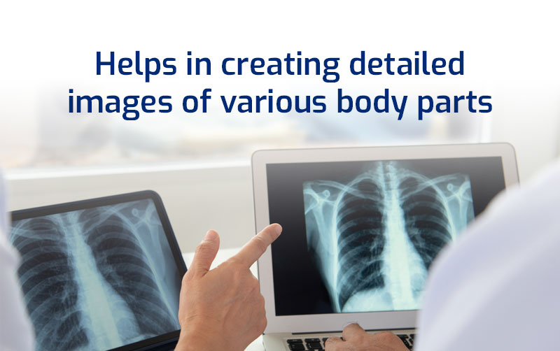 CT Scan: A Useful Imaging Technique for Detecting Possible Tumours or ...