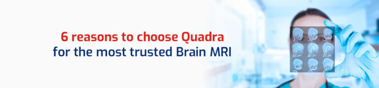 6 Reasons That Make Quadra the Best Brain MRI Test Centre in Kolkata