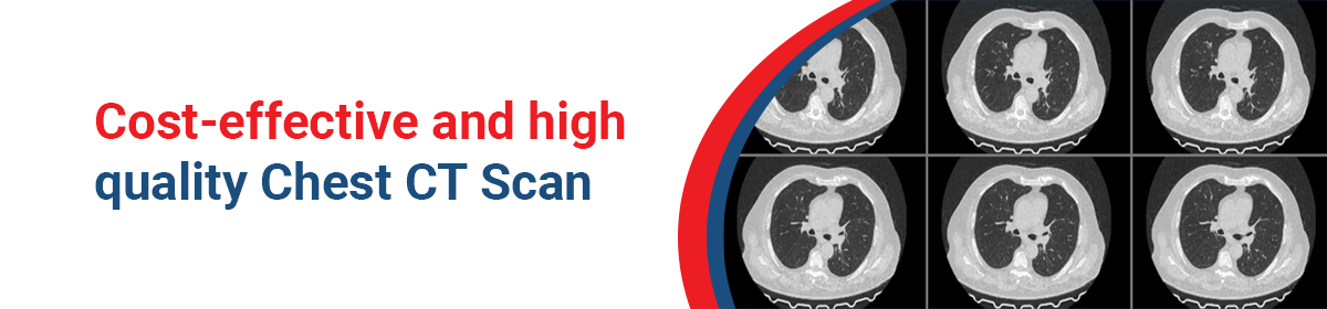 You are currently viewing Chest CT Scan in Kolkata: Where to Find the Best Cost and Quality