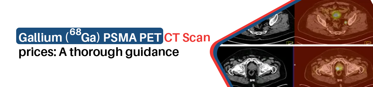 You are currently viewing PSMA PET CT Scan Costs in Kolkata: A Guide for Patients